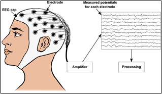 Electroencephalography (EEG), Advantages, Applications and Limitations_4.1