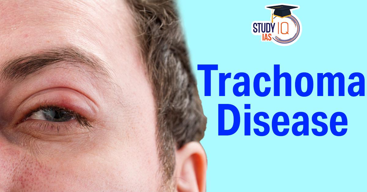 Trachoma Disease