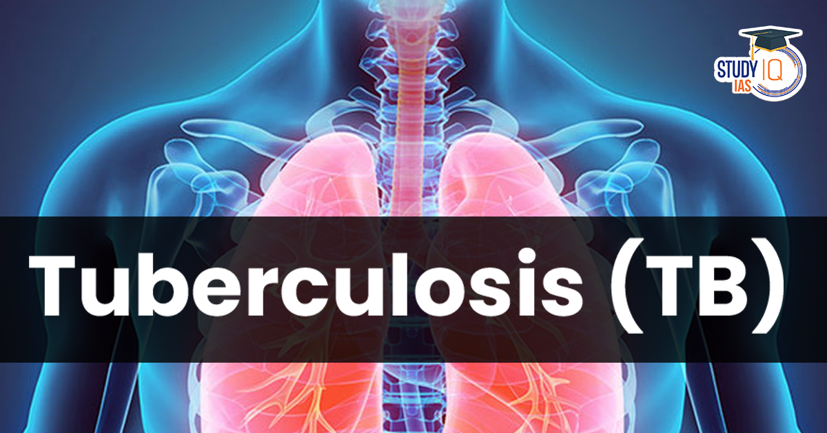 Tuberculosis (TB) in India
