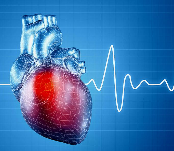 Pacemaker