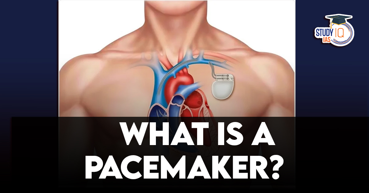 Pacemaker