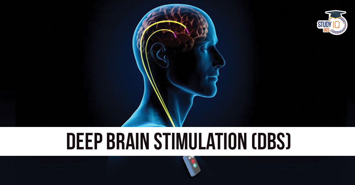 Deep Brain Stimulation (DBS)