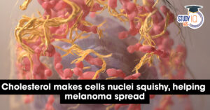 Cholesterol Makes Cell Nuclei Squishy: How It Helps Melanoma Spread