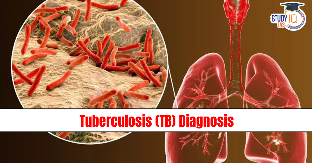 Tuberculosis (TB) Diagnosis