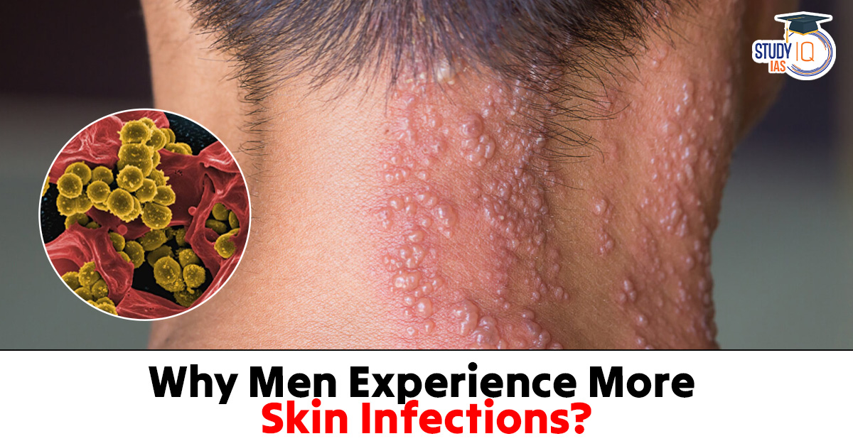 Men Experience More Skin Infections