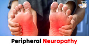Peripheral Neuropathy